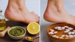 Heal Dry Cracked Heels Faster at Home Using Safe Kitchen Ingredients That Actually Work